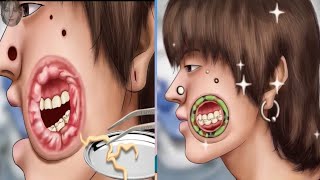 ASMR Cleaning big hole swollen face piercings  Removal#asmr#satisfying #animation