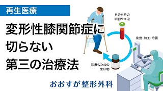 【膝や靭帯への再生医療】「切らない」新たな治療法～PFC-FD療法～