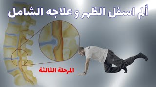 الدليل الشامل لعلاج الإنزلاق الغضروفي - عرق النسا - تضيق القناة الشوكية  - المرحلة الثالثة