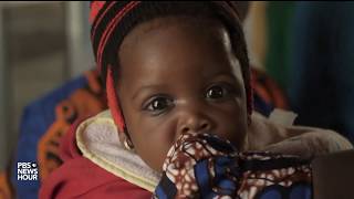 Why Nigeria has more HIV-positive infants than anywhere else