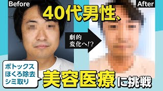 【イケおじ計画！】美容医療でアラフォー男性が大変身！？