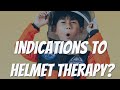 WHAT ARE THE INDICATIONS TO HELMET THERAPY? FLAT HEAD