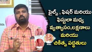 పైల్స్ , ఫిషర్ మరియు ఫిస్టులా మధ్య వ్యత్యాసం,లక్షణాలు మరియు చికిత్స పద్ధతులు.eaglehealth