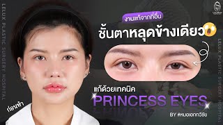 งานแก้จากที่อื่น! ชั้นตาหลุดข้างเดียว แก้ด้วยเทคนิค Princess Eyes