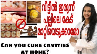 can you cure cavities at home?/ #drshilpa / പല്ലിലെ കേട് home remedies ഉപയോഗിച്ച് മാറ്റിയെടുക്കാമോ?