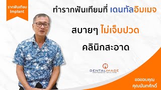 สบายๆ ไม่เจ็บปวด | รากฟันเทียม By เดนทัลอิมเมจ