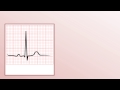 intro to ekg interpretation waveforms segments and intervals