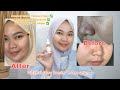 Review Whitelab Glow booster C-dose+ serum | serum untuk mencerahkan kulit wajah