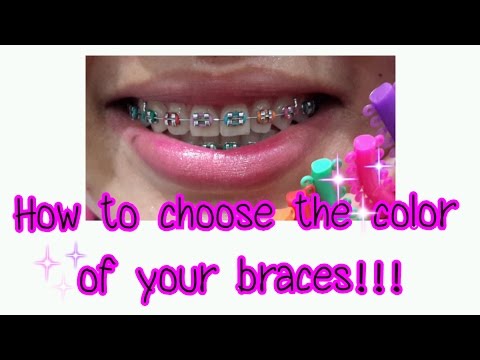 How to choose the color of your braces!!! How to choose the color of your braces!!!