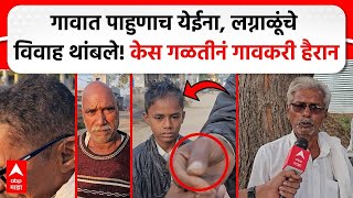 Buldhana Hair Fall : गावात पाहुणाच येईना, लग्नाळूंचे विवाह थांबले! केस गळतीनं गावकरी हैरान