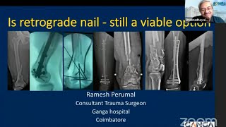 Dr Ramesh Perumal - Is retrograde Nail - Still a Viable Option