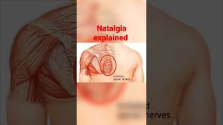 NOTALGIA meaning, causes explained #notalgia #solution