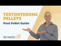 Post Testosterone Pellet Guide: What To Do Next