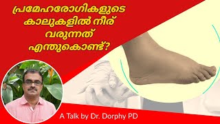 പ്രമേഹരോഗികളുടെ കാലുകളിൽ നീര് വരുന്നത് എന്തുകൊണ്ട്?  - Dr. DORPHY PD