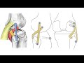 Posterolateral Corner of Knee: Repair Vs Reconstruction