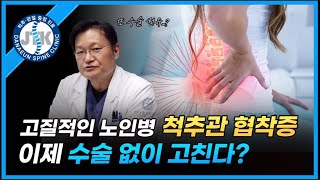 고질적인 노인병 척추관 협착증 이제 수술 없이 고친다