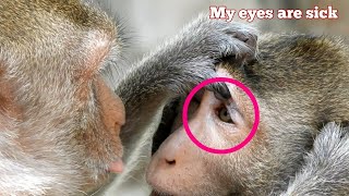 Great! eye treatment, Nice monkey always clean treatment to other monkey's eye.