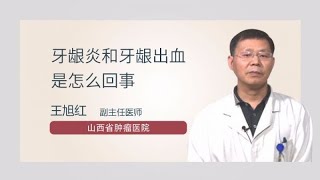 牙龈炎和牙龈出血是怎么回事 王旭红 山西省肿瘤医院