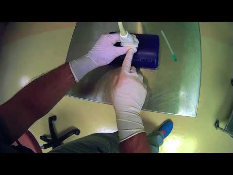 6 Holding The Ultrasound Probe 6 Holding The Ultrasound Probe