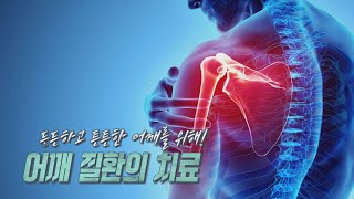 [TV메디컬 약손]20220628(639회)든든하고 튼튼한 어깨를 위해!_어깨 질환의 치료/정형외과 전문의 김동후 원장