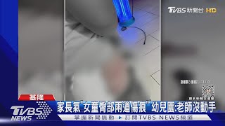 家長氣「女童臀部兩道傷痕」 幼兒園:老師沒動手｜TVBS新聞 @TVBSNEWS02