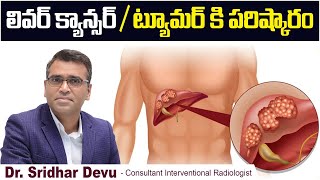 లివర్ క్యాన్సర్ / ట్యూమర్ || Liver Tumor Treatment Techniques || Liver Cancer || Dr Devu