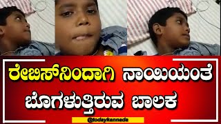 Rabies Virus : ನಾಯಿಯಿಂದ ಕಚ್ಚಿಸಿಕೊಂಡ ಆ ಬಾಲಕ ನಾಯಿಯಂತೆ ಬೊಗಳುತ್ತಿದ್ದಾನೆ.  | TODAYKANNADA