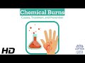 Burned by Chemicals: A Deep Dive into Causes, Treatment, and Avoidance