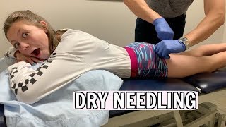 Gymnast Gets DRY NEEDLING For The First Time! Does it hurt?