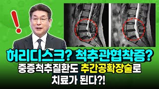 허리디스크 척추관협착증 동반한 중증척추질환도 추간공확장술로 개선가능