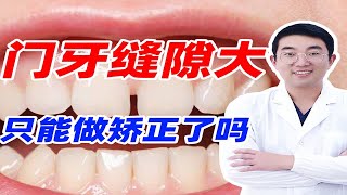 门牙缝隙大，只能矫正了吗？还有这种方法