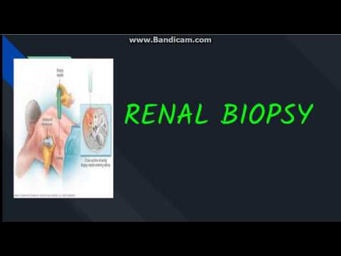 Renal Biopsy: Indication, Contraindication, Procedure And Complications ...