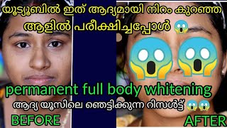 നിറം കുറഞ്ഞ അളിൽ പരീക്ഷിച്ചപ്പോൾ 😱 ഞെട്ടിക്കുന്ന റിസൾട്ട്‌/permanent full body whitening/shocked res