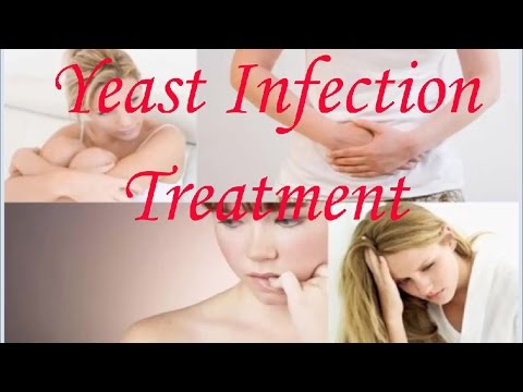 Here Are Some Common Causes Of Yeast Infection That You Should Know About Here Are Some Common Causes Of Yeast Infection That You Should Know About