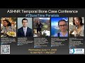 ASHNR Temporal Bone Case Conference #4