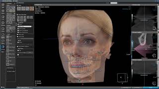 3D Ceph