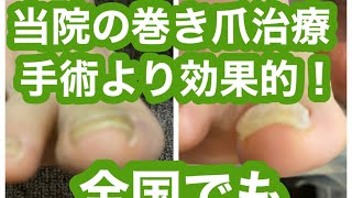 当院の巻き爪治療が手術より効果的で全国になかなか無い理由