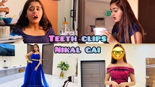 OMG! Finally Teeth Clips Nikal Gaye😍Before Valentine Day Celebrations 🥺 How Bindass Kavya Look Now