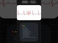 Create a Beating Heart Animation with HTML & CSS 💘