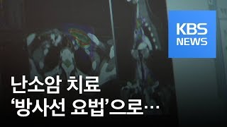 재발 많은 난소암…‘방사선 요법’ 치료로 잡는다 / KBS뉴스(News)