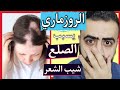 خبر صادم زيت الروزماري ( اكليل الجبل ) يسبب شيب الشعر و بعد التوقف عنه يسبب تساقط الشعر و الصلع