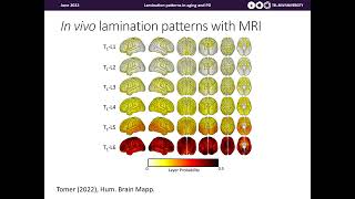 OHBM 2022 | 151 | Talk | Omri Tomer | Cortical lamination pattern differences in Parkinson’s disea…