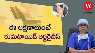 ఈ లక్షణాలుంటే రుమటాయిడ్ ఆర్థరైటిస్ | Rheumatoid Arthritis | Dr.Chiranjeevi | We Health