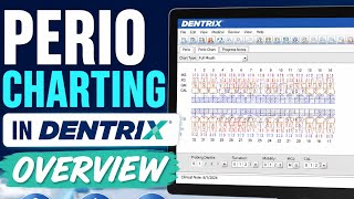 How to Do Perio Charting in Dentrix | Step-by-Step Tutorial for RDHs