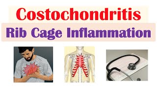 Costochondritis (Rib Cage Inflammation) | Causes, Symptoms, Diagnosis, Treatment