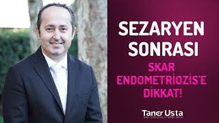 Sezaryen Sonrası Skar Endometriozis'e Dikkat! | Prof. Dr. Taner Usta