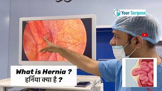 हर्निया क्या है ? HERNIA KYA HAI ? Meaning ? What is Hernia ?
