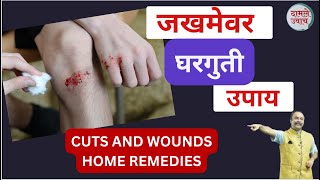 जखम किंवा घाव लागल्यास करा हे उपाय।ज़ख्मों घावके घरेलू उपाय।Cuts and Wounds Remedies | Jakham Upay