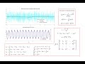 Numerical Differentiation of Noisy Data (DoG and Savitzky–Golay Filters)