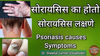 #psoriasis #सोरायसिस लक्षणे सोरायसिस का होतो #psoriasisdiet #ayurveda #marathi